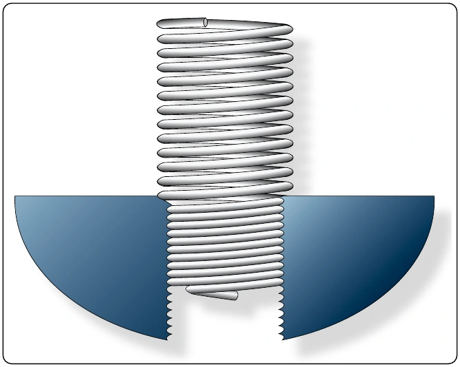 Figure 7-31. Helicoil insert.