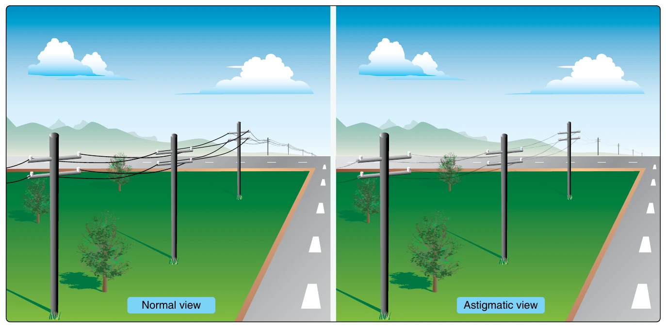 Figure 12-2. Example of a view that might be experienced by someone with astigmatism.