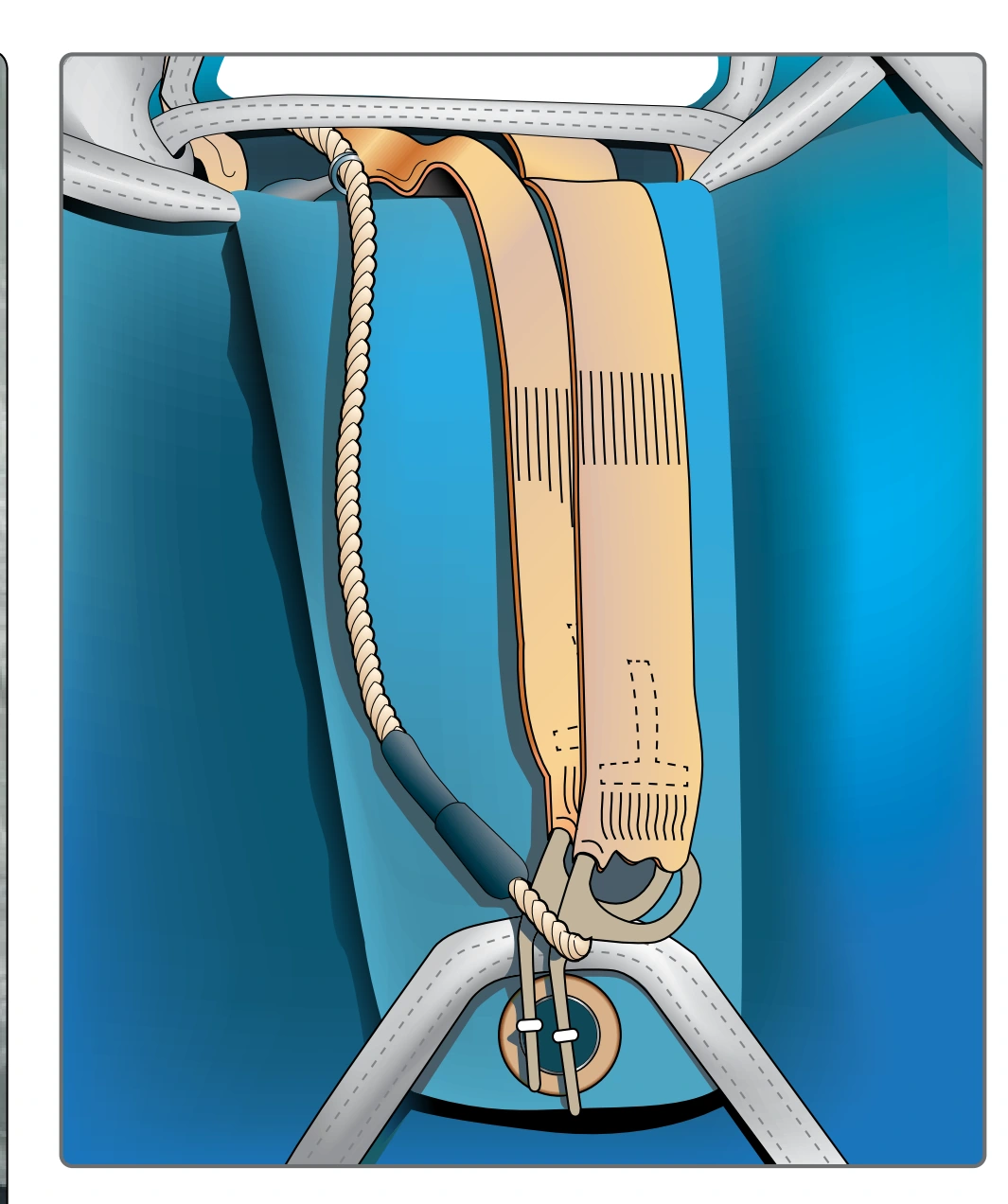 Figure 2-51. LOR system.