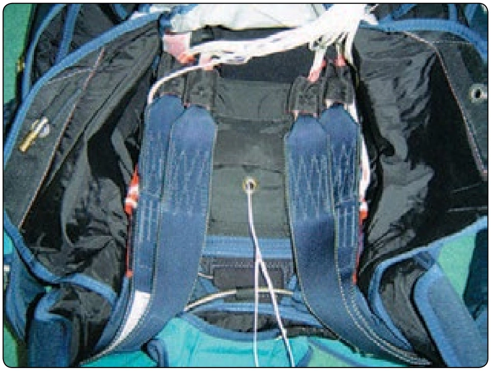 Figure 5-104. Place risers in the pack tray and spread.