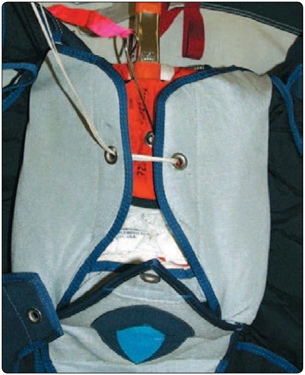 Figure 5-111. Close right and left flaps simultaneously.