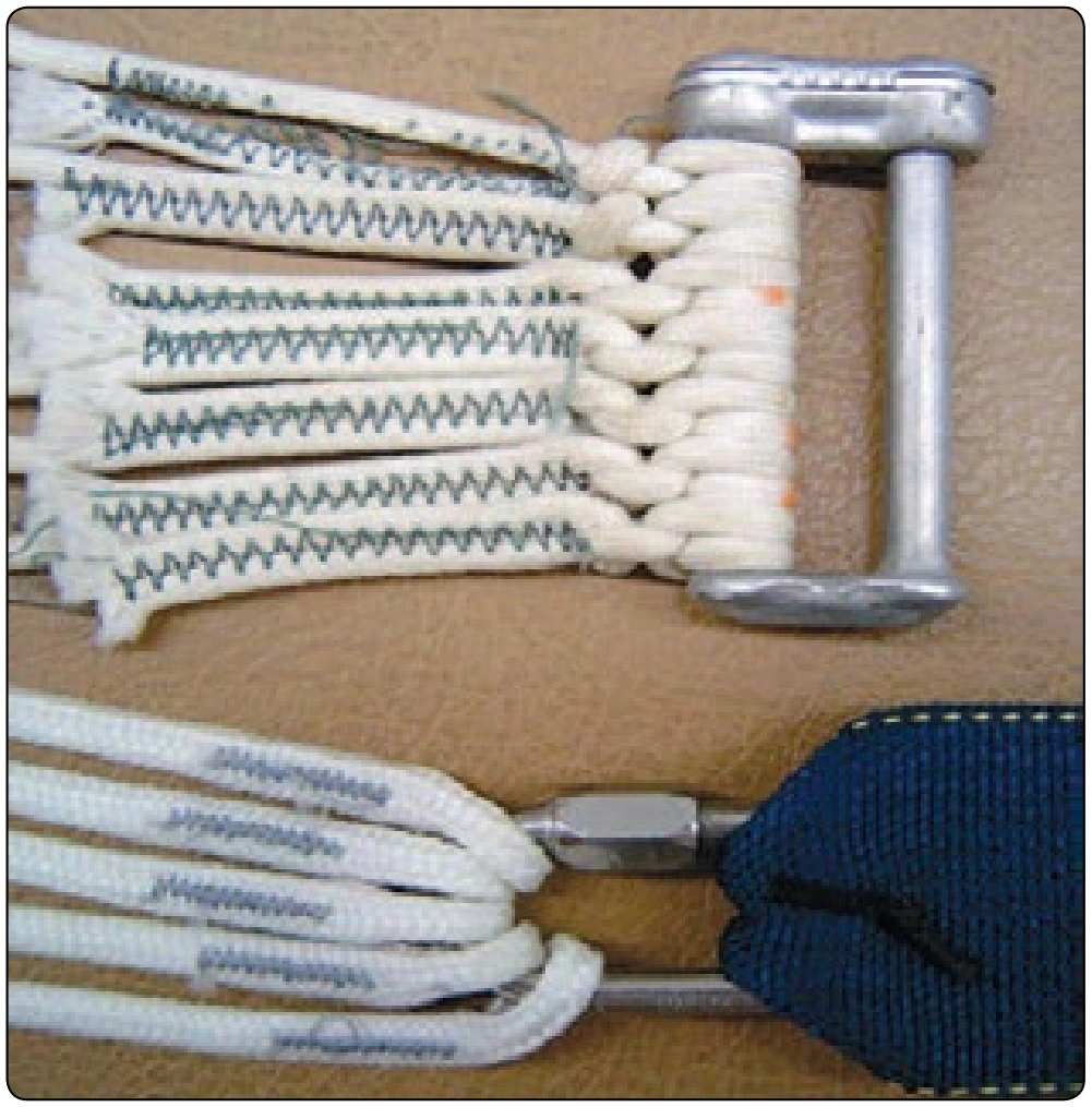 Figure 5-13. Connector link line attachment methods.