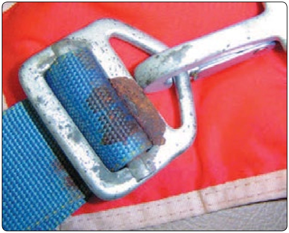 Figure 5-17. Rusty leg snap hardware.