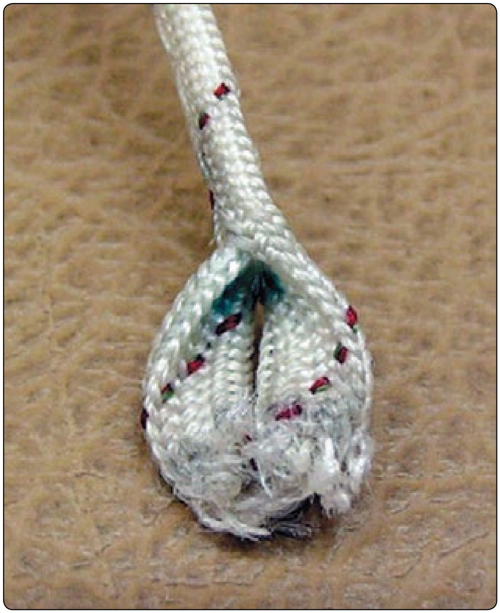 Figure 5-18. Worn closing loop.
