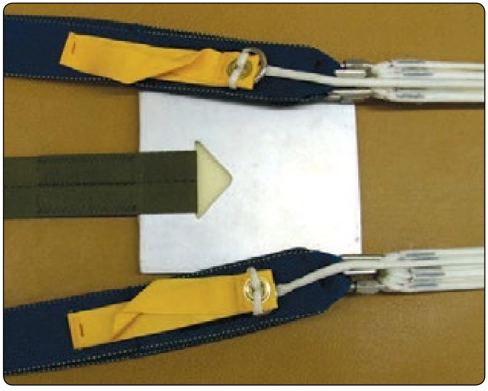 Figure 5-33. Riser and connector links attached to the tension board.