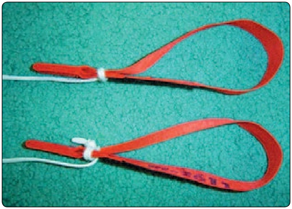 Figure 5-70. Tying toggles.