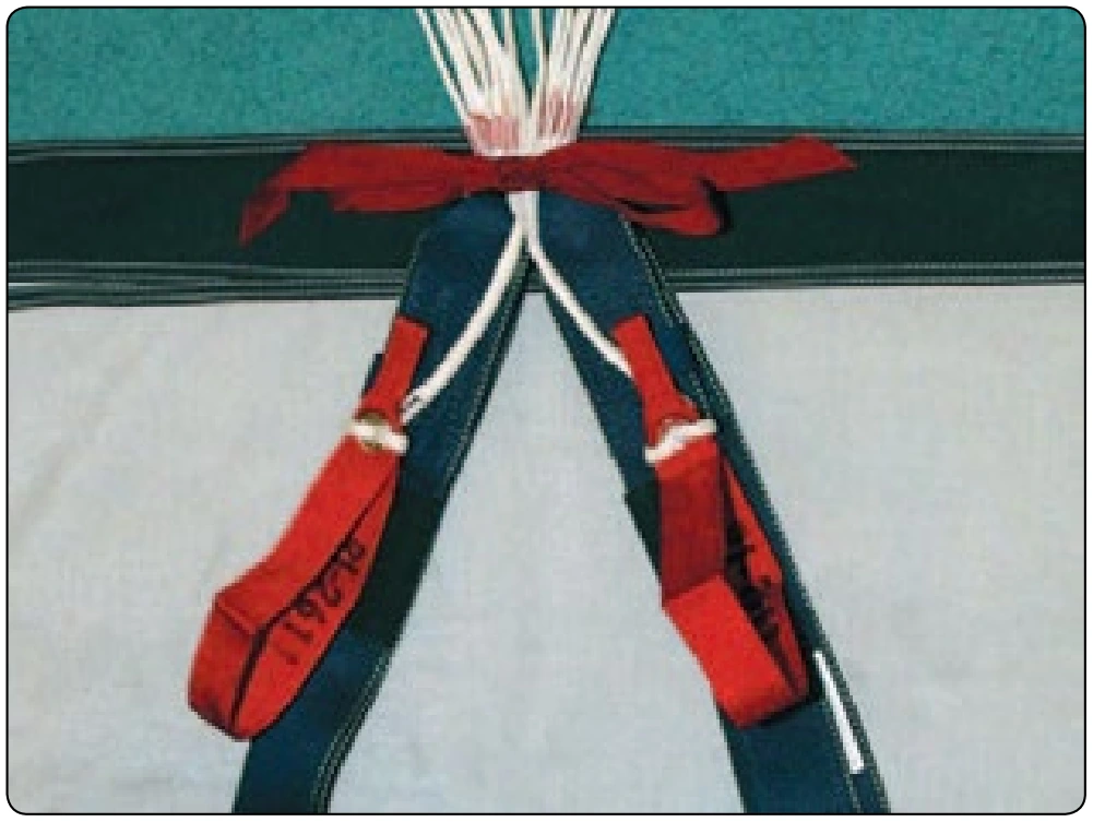 Figure 5-71. Anchor risers.