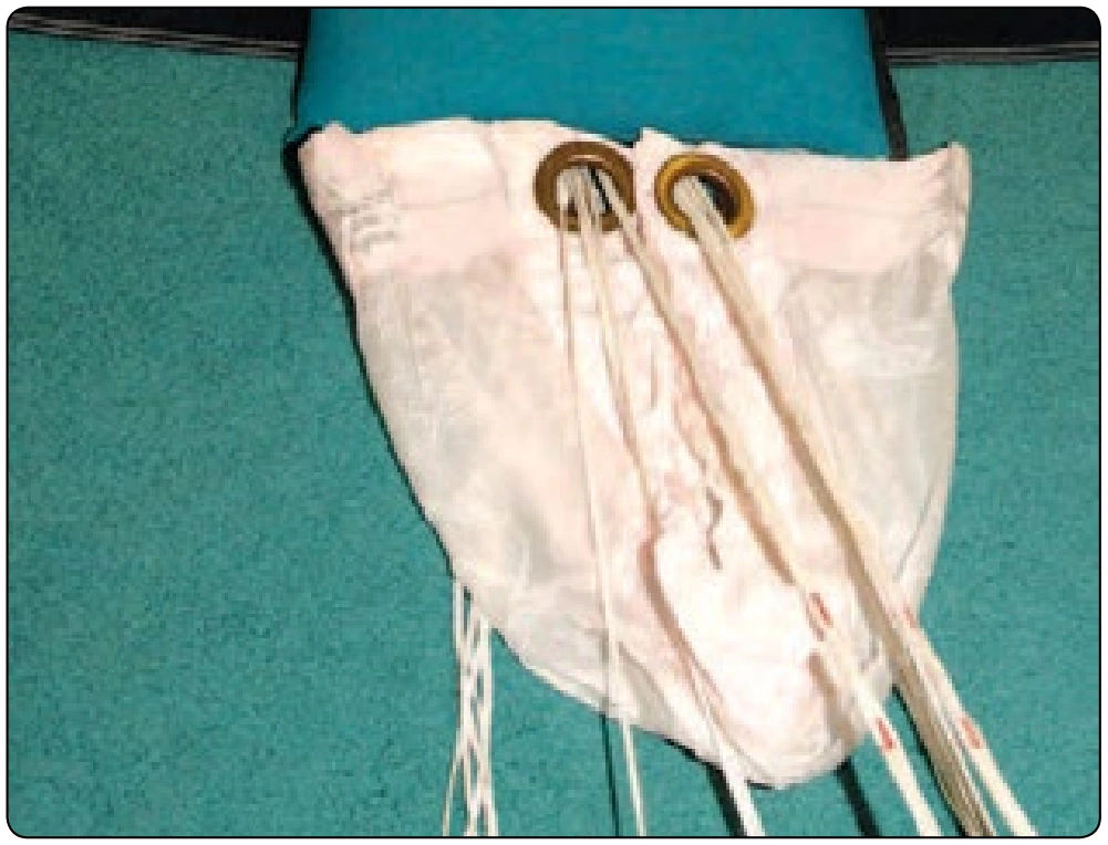 Figure 5-72. Pull slider down.