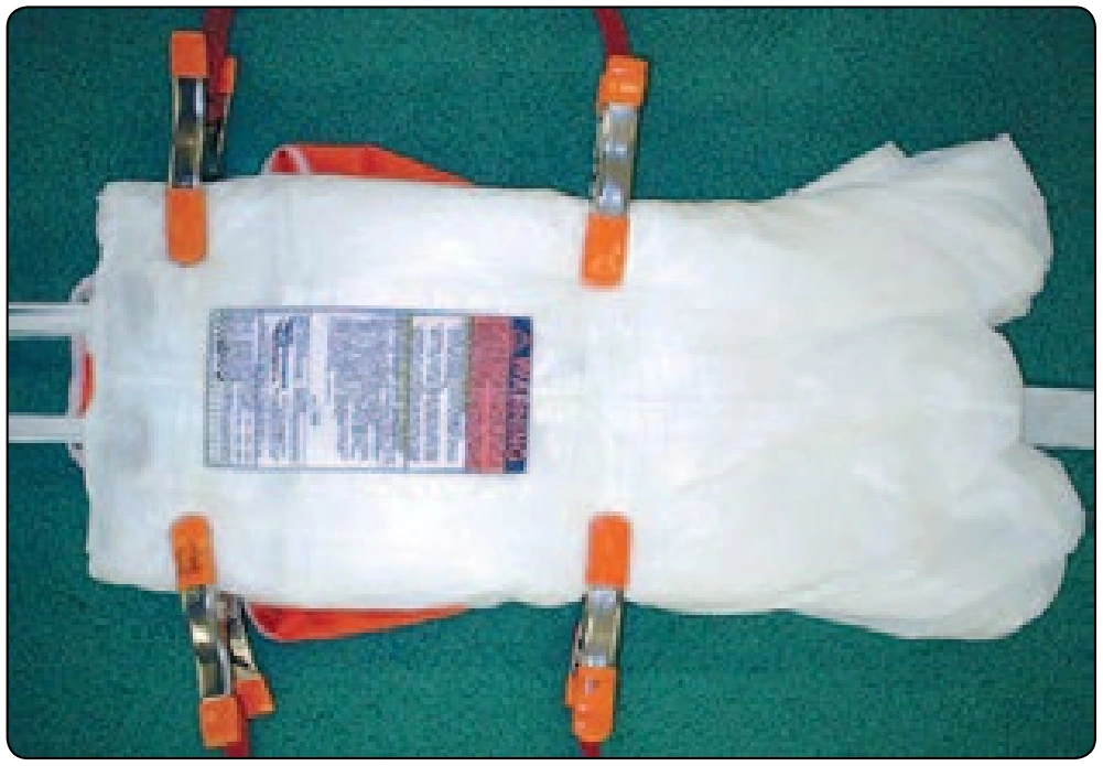 Figure 5-95. Bag positioned under canopy.