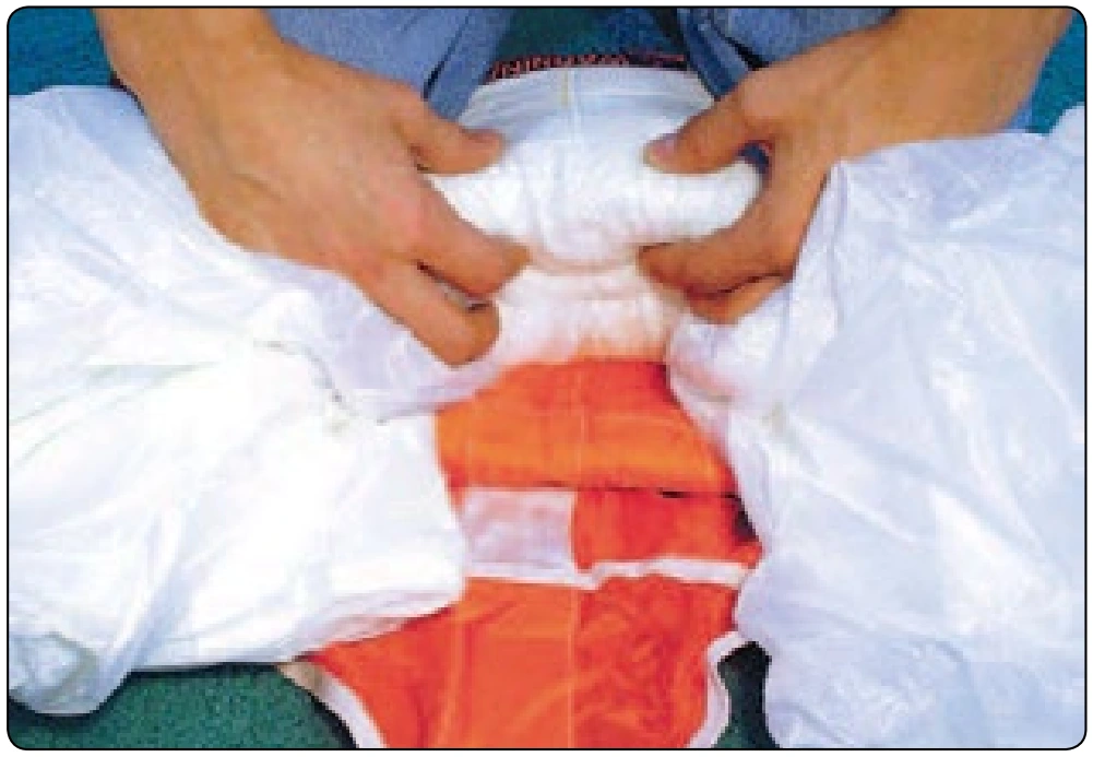 Figure 5-98. Gather and roll center seam fabric.