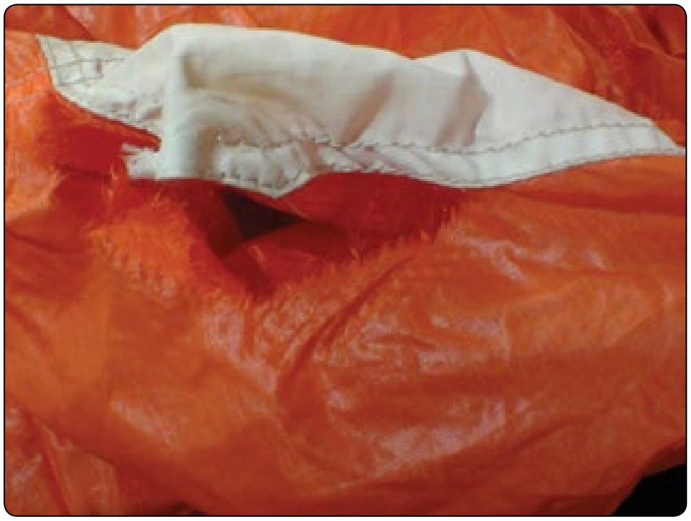 Figure 7-11. Pilot chute attachment damage is not always obvious.