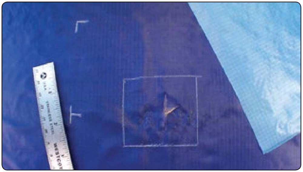 Figure 7-16. Patch layout.