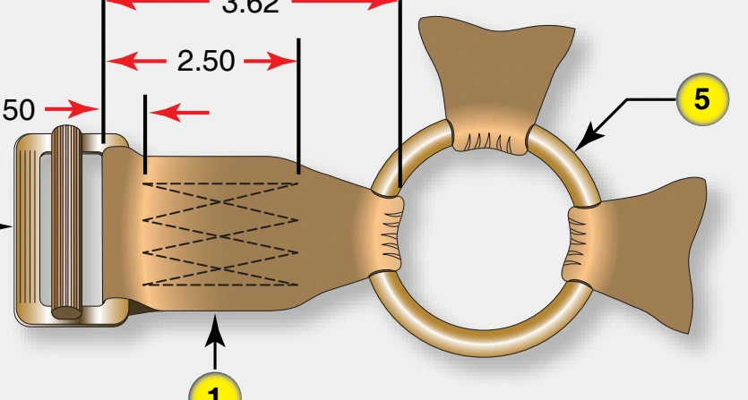 Articulated Upper Leg Hardware Replacement, procedure photograph 1 (source page 7-57).