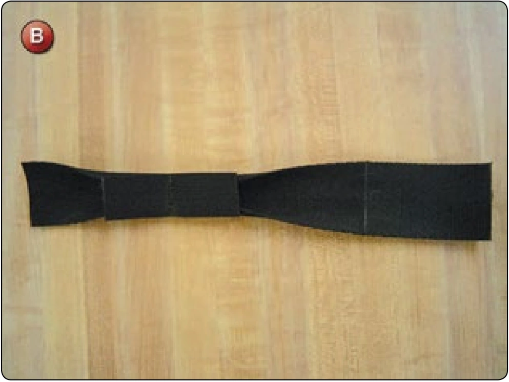 Articulated Upper Leg Hardware Replacement, procedure photograph 2 (source page 7-57).