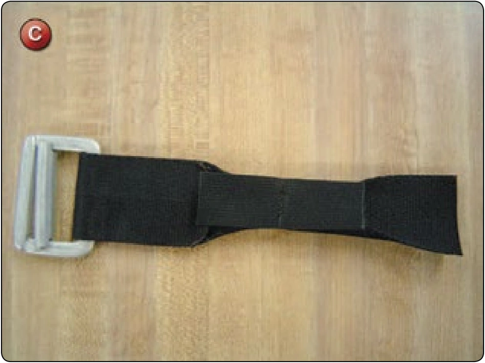Articulated Upper Leg Hardware Replacement, procedure photograph 3 (source page 7-57).
