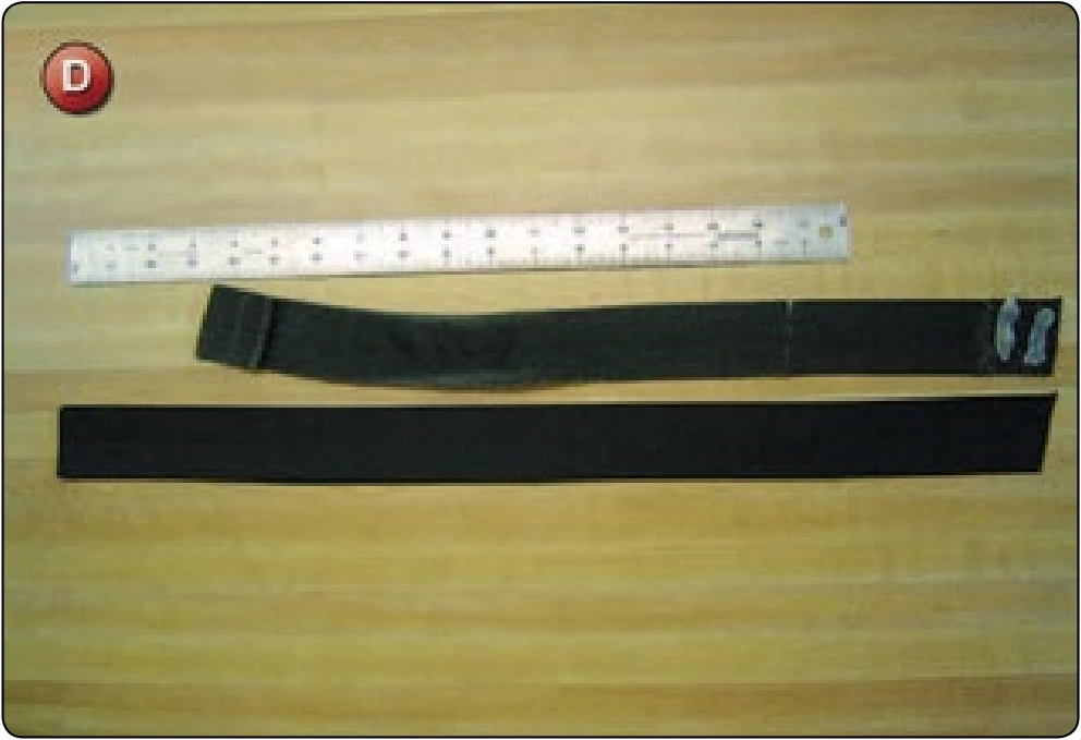 Chest Strap Replacement, procedure photograph 4 (source page 7-52).