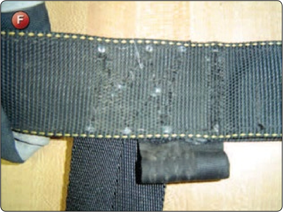 Chest Strap Replacement, procedure photograph 6 (source page 7-53).
