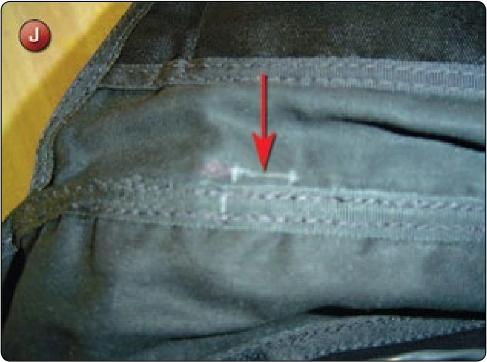 Cutter Channel and Elastic Installation, procedure photograph 1 (source page 7-79).