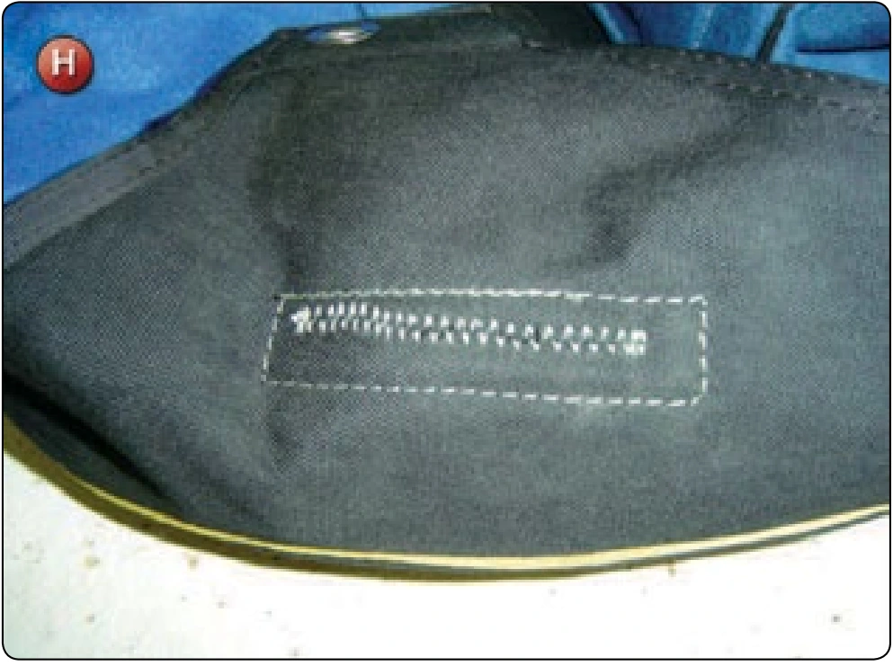 Hidden Patches, procedure photograph 3 (source page 7-40).