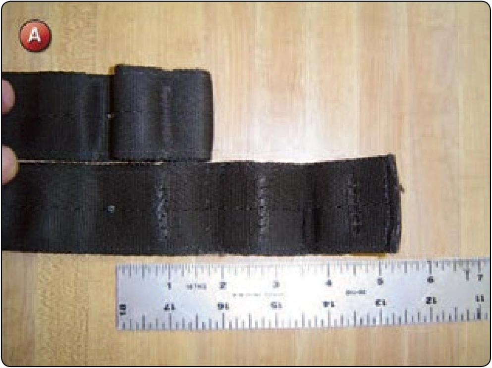 Lower Leg Strap Shortening, procedure photograph 1 (source page 7-54).