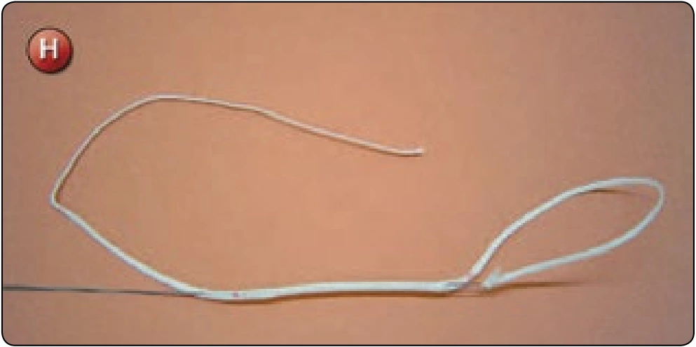 Main Deployment Bag, procedure photograph 1 (source page 7-82).