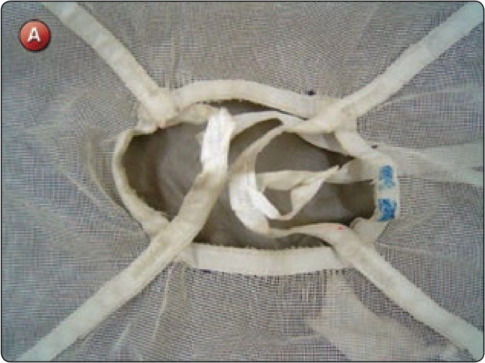 Main Pilot Chute Collapsible Bridle Replacement, procedure photograph 1 (source page 7-69).