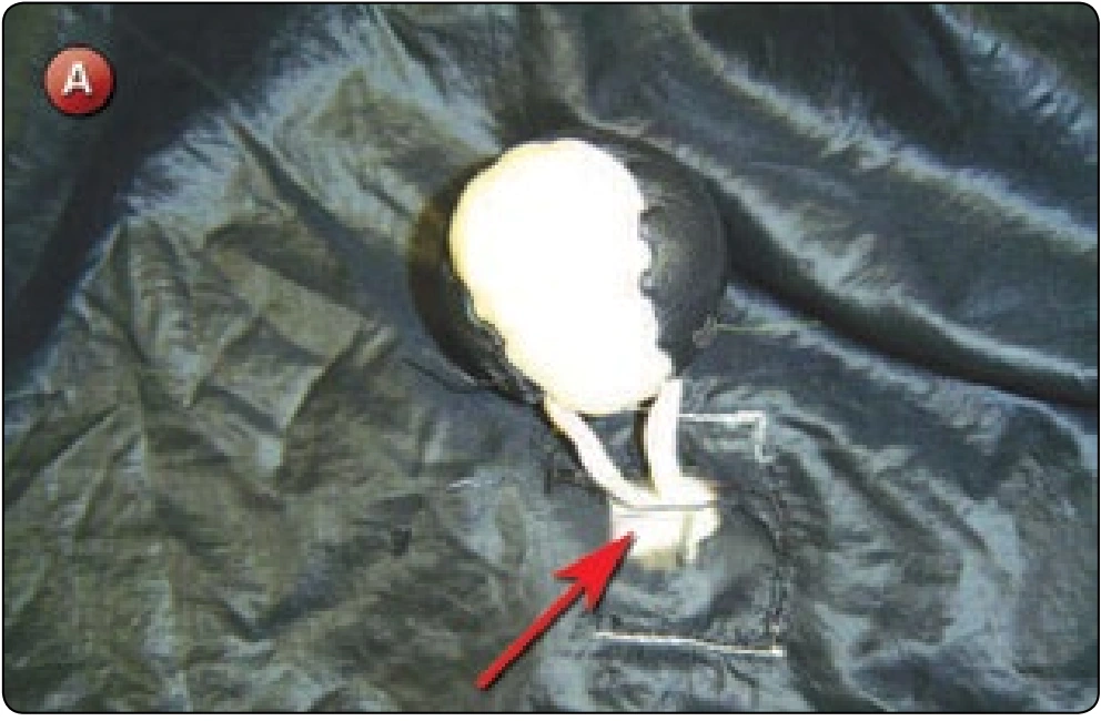 Main Pilot Chute Repair—Top Canopy Reinforcing, procedure photograph 1 (source page 7-68).