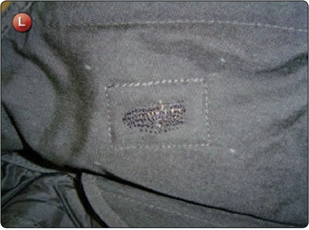 Overlay Patches, procedure photograph 4 (source page 7-41).