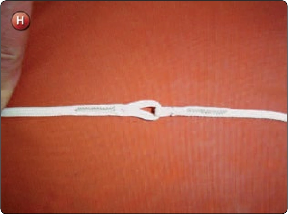 Square Canopy—Control Line Replacement, procedure photograph 7 (source page 7-35).
