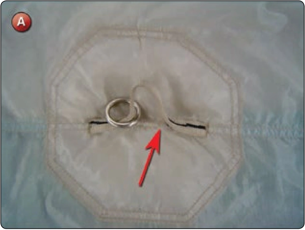 Square Canopy—Pilot Chute Attachment Point Repair, procedure photograph 1 (source page 7-29).