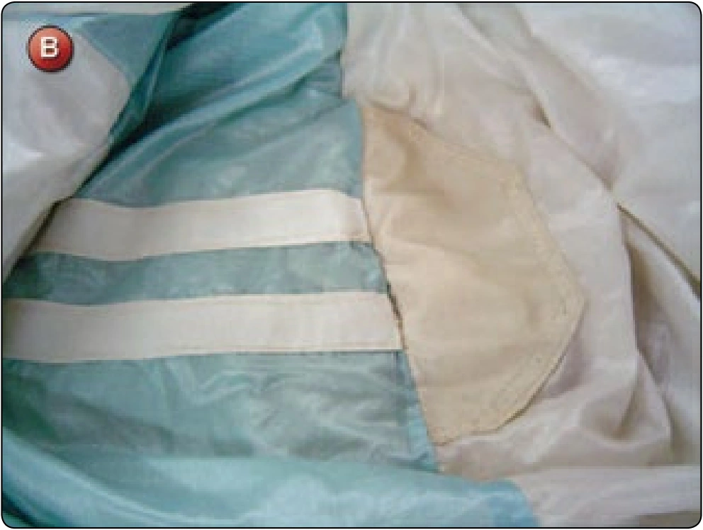 Square Canopy—Pilot Chute Attachment Point Repair, procedure photograph 2 (source page 7-29).