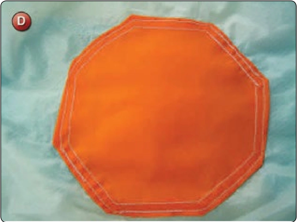 Square Canopy—Pilot Chute Attachment Point Repair, procedure photograph 4 (source page 7-29).