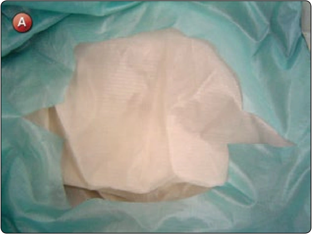 Square Canopy—Rib Repair, procedure photograph 1 (source page 7-25).