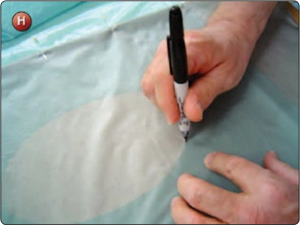 Square Canopy—Rib Repair, procedure photograph 8 (source page 7-27).